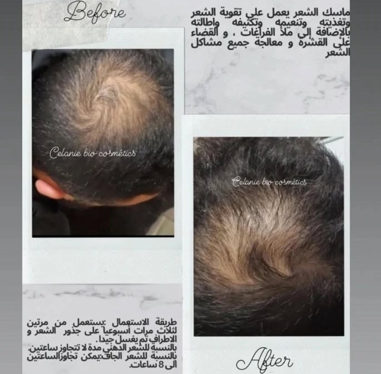 Masque Capillaire pour Hommes – Formule Hautement Concentrée en Huiles